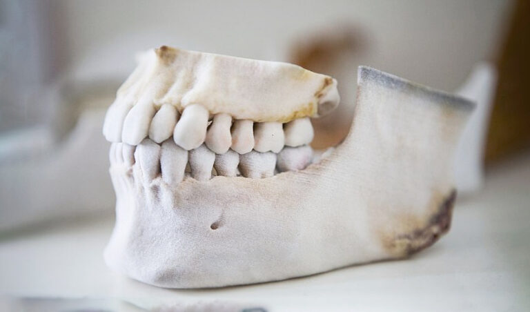 بهینه سازی عمل جراحی با استفاده از پرینت سه بعدی