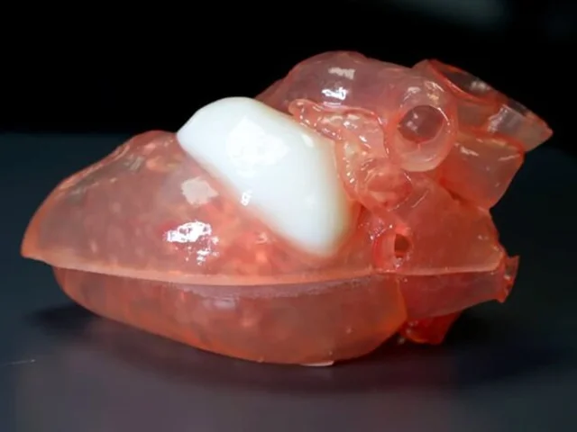 گسترش پرینت سه بعدی پزشکی در آمریکای شمالی